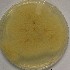  (Aspergillus niger - S1-i)  @11 [ ] CreativeCommons - Attribution Share-Alike (2019) Unspecified Botswana International University of Science and Technology