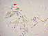  (Gomphonema parvulum - LEV316)  @11 [ ] Copyright (2020) Unspecified Palacky University Olomouc