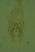  (Micropsectra sp. 2SW - ZSM34343-B01)  @11 [ ] Unspecified (default): All Rights Reserved  SNSB, Staatliche Naturwissenschaftliche Sammlungen Bayerns ZSM (SNSB, Zoologische Staatssammlung Muenchen)