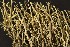  (Cladonia usambarensis - O-L-48)  @11 [ ] CreativeCommons - Attribution Non-Commercial (2013) Siri Rui Natural History Museum, University of Oslo, Norway