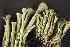  (Cladonia straminea - O-L-184718)  @11 [ ] CreativeCommons - Attribution Non-Commercial (2013) Siri Rui Natural History Museum, University of Oslo, Norway