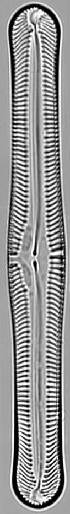  (Pinnularia macilenta - STAP3)  @11 [ ] Copyright (2017) Pieter Vanormelingen Ghent University, Protistology and Aquatic Ecology