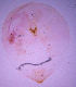  (Aspidiella hartii - ARC-PPRI SB295_3)  @11 [ ] CreativeCommons - Attribution Non-Commercial Share-Alike (2011) Mamadi Theresa Sethusa ARC-PPRI